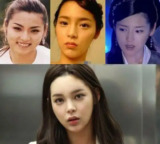 崔智友蔡琳尹恩惠刘仁娜刘荷娜韩恩贞金宣儿郑丽媛李多海朴诗妍_韩国整容女明星颜值变化_韩剧整容女明星